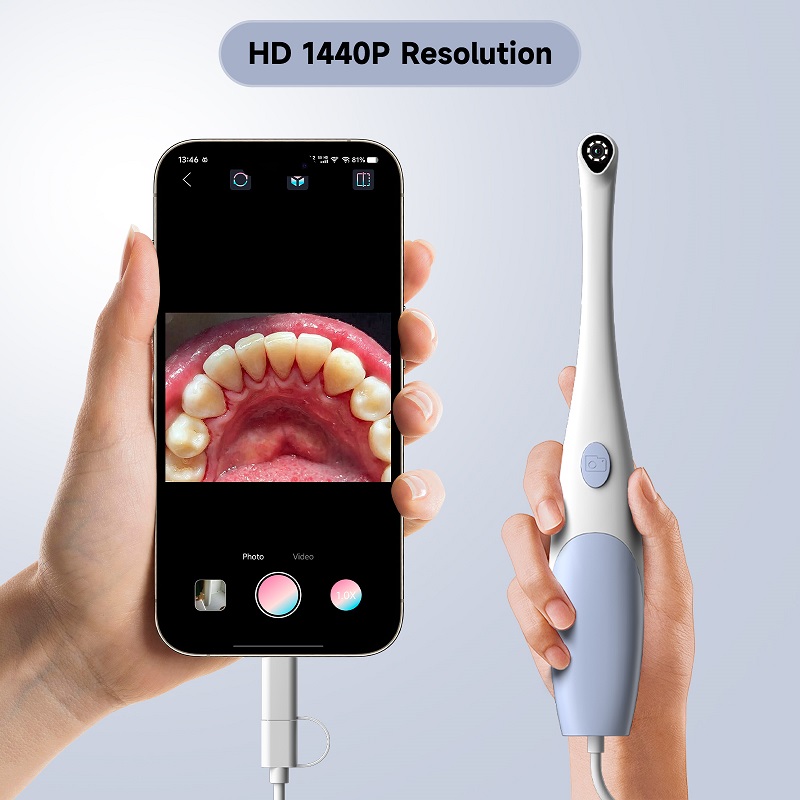 Cámara endoscópica oral 1440P, - Photography Lighting Products reseña y precio